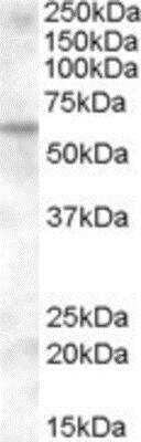 Western Blot: KPNA6 Antibody [NB100-93456]