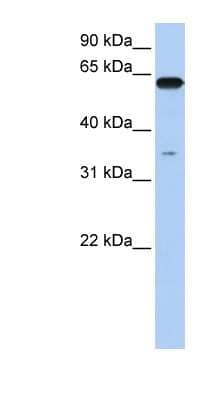 Western Blot: KPNA6 Antibody [NBP1-52953]