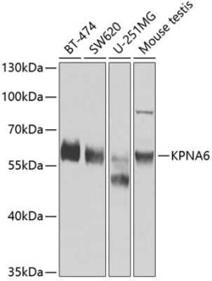 Western Blot: KPNA6 AntibodyBSA Free [NBP3-04919]