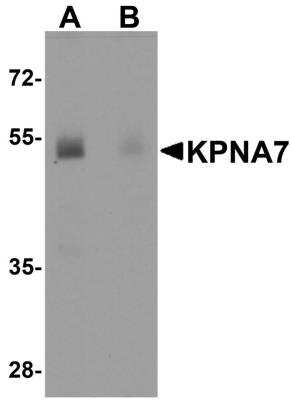 Western Blot: KPNA7 AntibodyBSA Free [NBP2-81730]