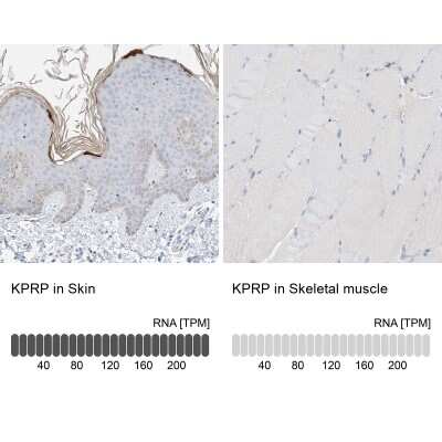 Immunohistochemistry-Paraffin: KPRP Antibody [NBP1-90707]