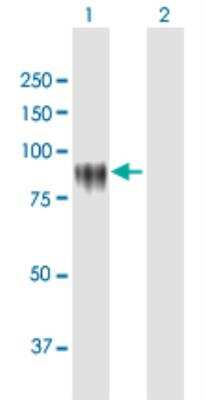 Western Blot: KPRP Antibody [H00448834-B01P-50ug]