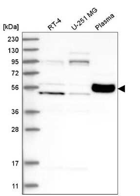 Western Blot: KPRP Antibody [NBP2-38194]