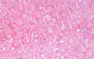 Immunohistochemistry-Paraffin: KRAS Antibody [NBP3-14386]