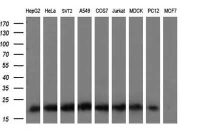 Western Blot: KRAS Antibody (OTI2C1) [NBP2-45536]