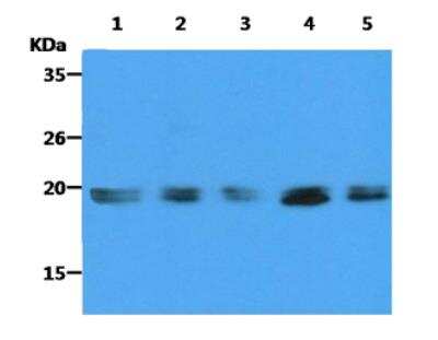 Western Blot: KRAS Antibody (2F8)BSA Free [NBP2-59413]