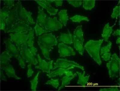 Immunocytochemistry/ Immunofluorescence: KRAS Antibody (3B10-2F2) [H00003845-M01]