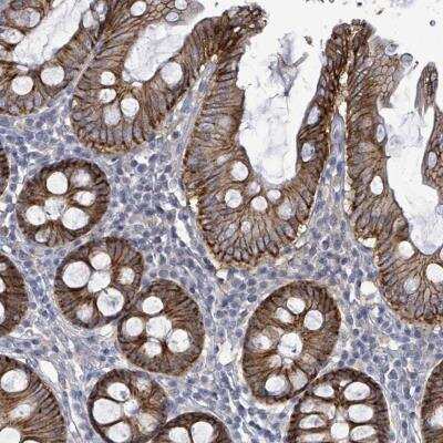 Immunohistochemistry-Paraffin: KRAS Antibody [NBP2-33579]