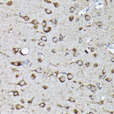 Immunohistochemistry-Paraffin: KRAS [p Ser89] Antibody - Azide and BSA Free [NBP3-16933]