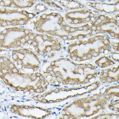 Immunohistochemistry-Paraffin: KRAS [p Ser89] Antibody - Azide and BSA Free [NBP3-16933]