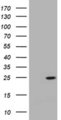 Western Blot: KRAS Antibody (OTI1D1)Azide and BSA Free [NBP2-71078]