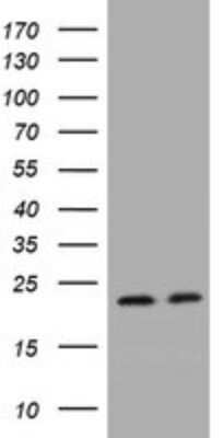 Western Blot: KRAS Antibody (OTI2C1)Azide and BSA Free [NBP2-71079]