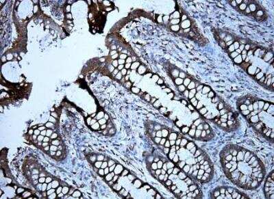 Immunohistochemistry-Paraffin: KRAS Antibody (OTI2C1) [NBP2-45536]