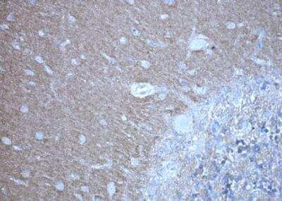 Immunohistochemistry-Paraffin: KRAS Antibody (OTI2C1) [NBP2-45536]