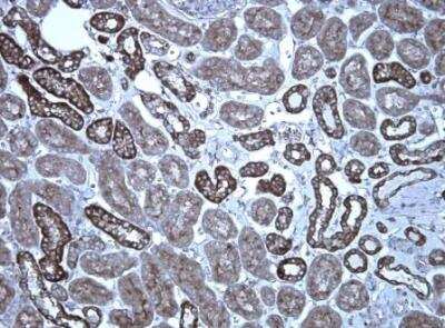 Immunohistochemistry-Paraffin: KRAS Antibody (OTI2C1) [NBP2-45536]