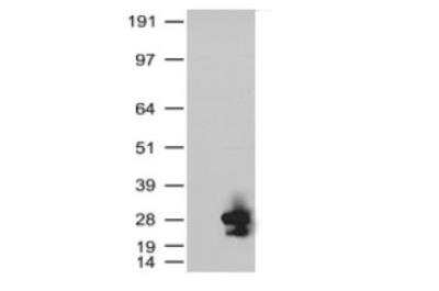 Western Blot: KRAS Antibody (OTI2C1) [NBP2-45536]