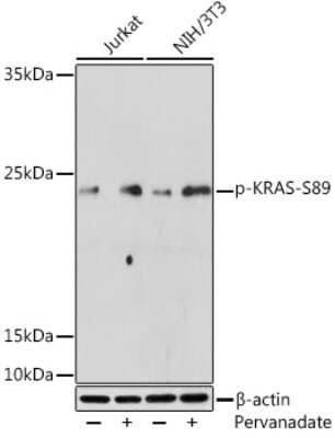 Western Blot: KRAS [p Ser89] AntibodyAzide and BSA Free [NBP3-16933]