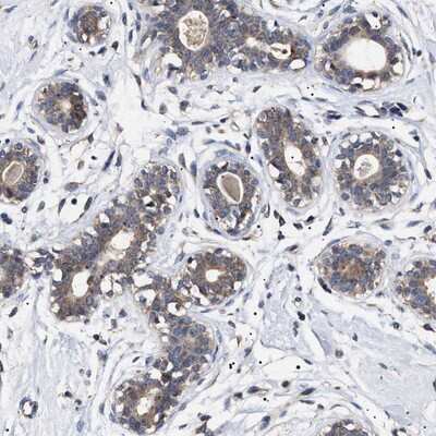 Immunohistochemistry-Paraffin: KRBA1 Antibody [NBP1-81365]