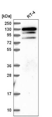 Western Blot: KRBA1 Antibody [NBP2-58786]