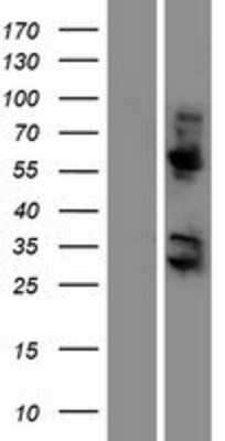 Western Blot: KRBA2 Overexpression Lysate [NBP2-04476]