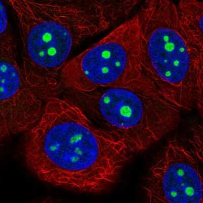 Immunocytochemistry/ Immunofluorescence: KRI1 Antibody [NBP2-14174]