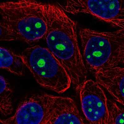 Immunocytochemistry/ Immunofluorescence: KRI1 Antibody [NBP2-14797]