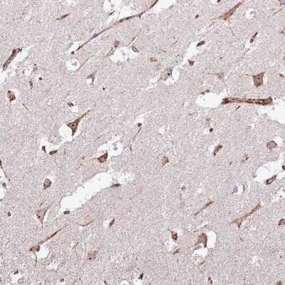 Immunohistochemistry-Paraffin: KRI1 Antibody [NBP2-14174]