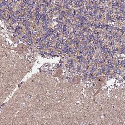 Immunohistochemistry-Paraffin: KRI1 Antibody [NBP2-14797]