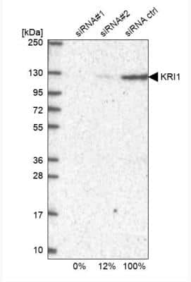 Western Blot: KRI1 Antibody [NBP2-14797]