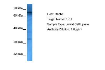 Western Blot: KRI1 Antibody [NBP2-85165]