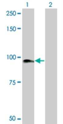 Western Blot: KRIT1 Antibody (2C7) [H00000889-M01]