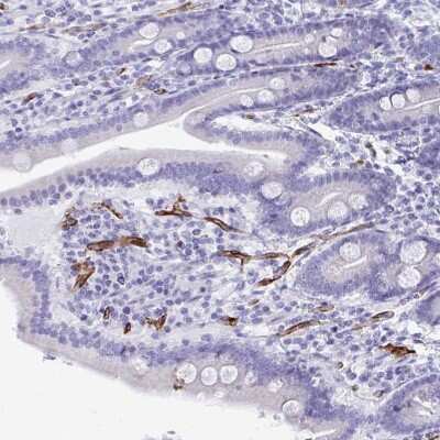 Immunohistochemistry-Paraffin: KRIT1 Antibody [NBP2-47405]