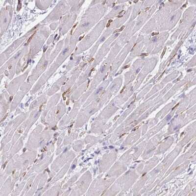Immunohistochemistry-Paraffin: KRIT1 Antibody [NBP2-47405]
