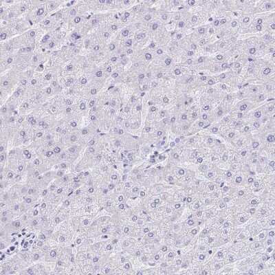 Immunohistochemistry-Paraffin: KRIT1 Antibody [NBP2-47405]