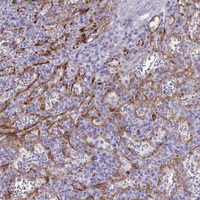 Immunohistochemistry-Paraffin: KRIT1 Antibody [NBP2-47405]