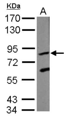 Western Blot: KRIT1 Antibody [NBP2-19307]