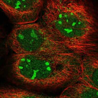 Immunocytochemistry/ Immunofluorescence: KRR1 Antibody [NBP2-58766]