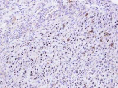 Immunohistochemistry-Paraffin: KRR1 Antibody [NBP1-32859]