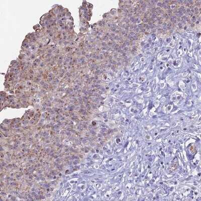 Immunohistochemistry-Paraffin: KRR1 Antibody [NBP1-92060]