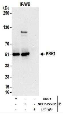 Immunoprecipitation: KRR1 Antibody [NBP2-22252]