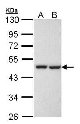 Western Blot: KRR1 Antibody [NBP1-32859]