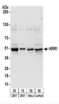 Western Blot: KRR1 Antibody [NBP2-22252]