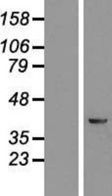 Western Blot: KRR1 Overexpression Lysate [NBL1-12379]