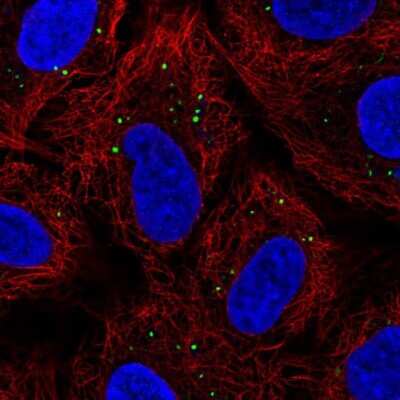 Immunocytochemistry/ Immunofluorescence: KRT222 Antibody [NBP2-46822]