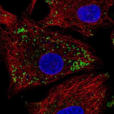 Immunocytochemistry/ Immunofluorescence: KRT222 Antibody [NBP2-57205]