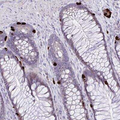 Immunohistochemistry: KRT222 Antibody [NBP2-46822]