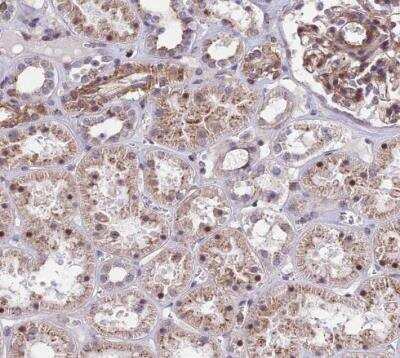 Immunohistochemistry-Paraffin: KRT222 Antibody [NBP1-92061]
