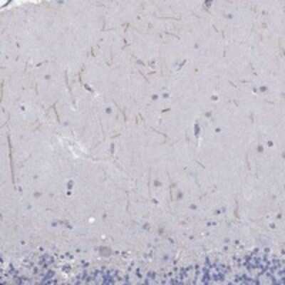 Immunohistochemistry-Paraffin: KRT222 Antibody [NBP3-17269]