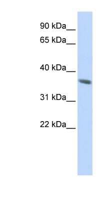 Western Blot: KRT222 Antibody [NBP1-70595]