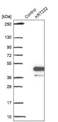 Western Blot: KRT222 Antibody [NBP1-92061]